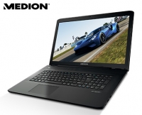 Aldi S&uuml;d  MEDION&reg;Notebook 43,9 cm (17,3 Zoll) MEDION&reg; P7648